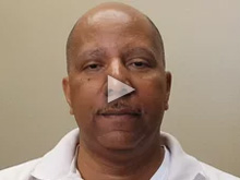 Alonzo - Prostate Cancer HIFU Treatment Patient Testimonial